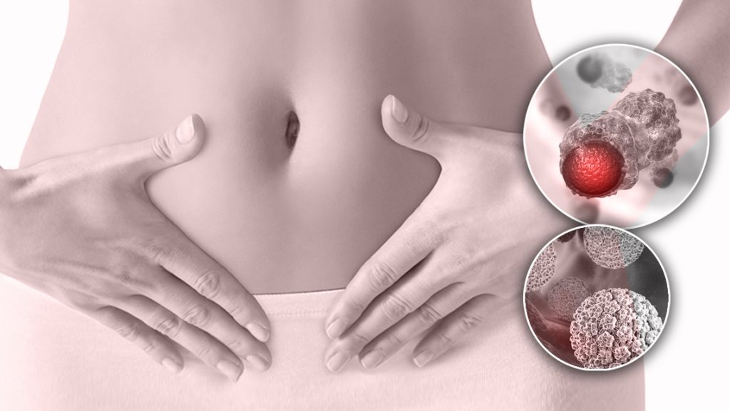 درمان زگیل تناسلی با طب سنتی