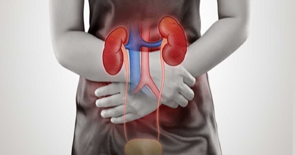 درمان عفونت ادراری